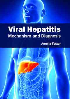 Viral Hepatitis: Mechanism and Diagnosis