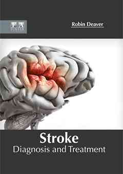 Stroke: Diagnosis and Treatment