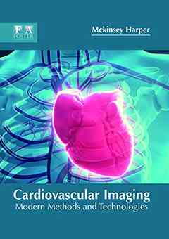 Cardiovascular Imaging: Modern Methods and Technologies
