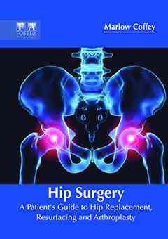 Hip Surgery: A Patient's Guide to Hip Replacement, Resurfacing and Arthroplasty