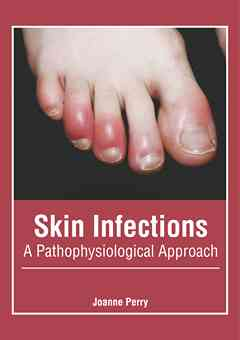 Skin Infections: A Pathophysiological Approach