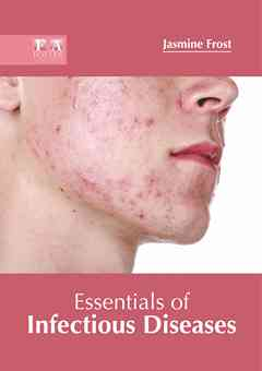 Essentials of Infectious Diseases