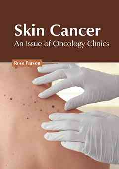 Skin Cancer: An Issue of Oncology Clinics