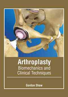 Arthroplasty: Biomechanics and Clinical Techniques