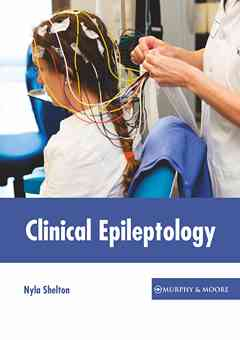 Clinical Epileptology