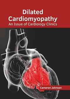 Dilated Cardiomyopathy: An Issue of Cardiology Clinics