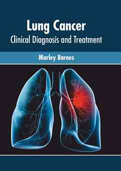 Lung Cancer: Clinical Diagnosis and Treatment