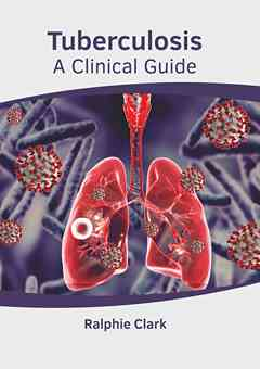 Tuberculosis: A Clinical Guide