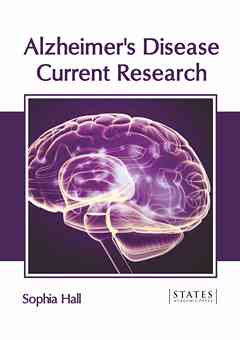 Alzheimer's Disease: Current Research