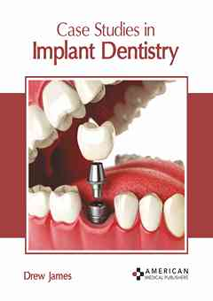 Case Studies in Implant Dentistry
