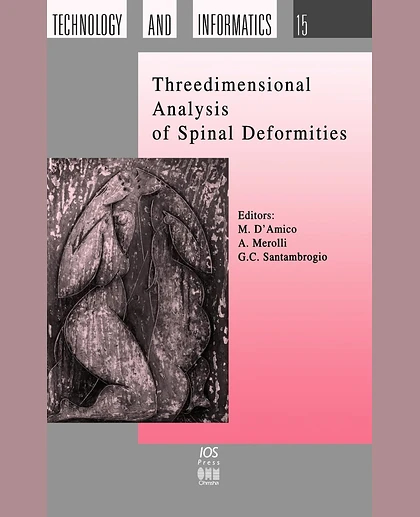 Threedimensional Analysis of Spinal Deformities, 1st Edition