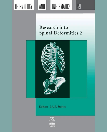 Research into Spinal Deformities 2, 1st Edition