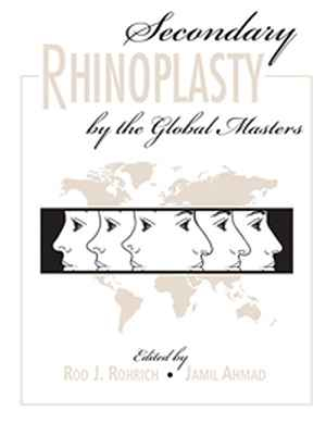Secondary Rhinoplasty