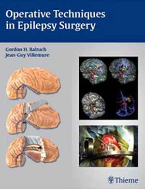 Operative Techniques in Epilepsy Surgery 1st