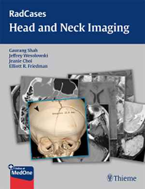 RadCases Head and Neck Imaging 1st