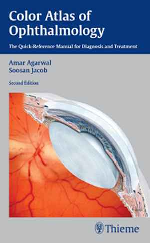 Color Atlas of Ophthalmology: The Quick-Reference Manual for Diagnosis and Treatment 2nd