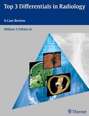Top 3 Differentials in Radiology: A Case Review 1st