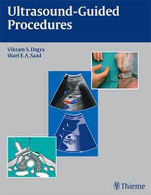 Ultrasound-Guided Procedures 1st