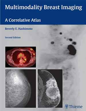 Multimodality Breast Imaging: A Correlative Atlas 2nd