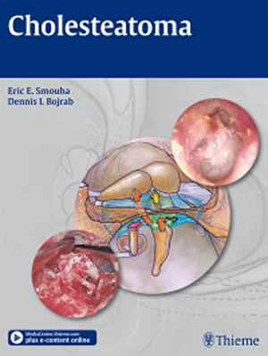 Cholesteatoma 1st