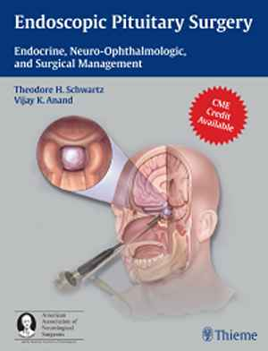 Endoscopic Pituitary Surgery: Endocrine, Neuro-Ophthalmologic, and Surgical Management 1st