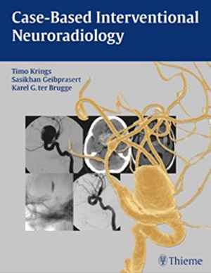 Case-Based Interventional Neuroradiology 1st