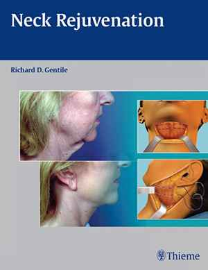 Neck Rejuvenation 1st