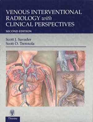 Venous Interventional Radiology With Clinical Perspectives 2nd