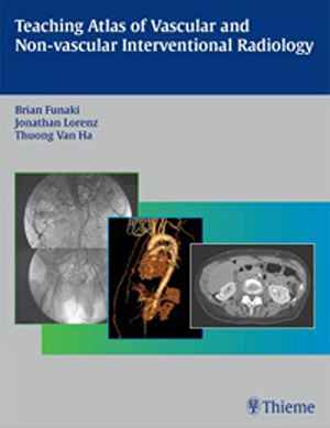 Teaching Atlas of Vascular and Non-vascular Interventional Radiology 1st