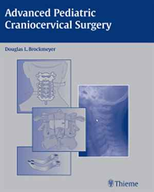 Advanced Pediatric Craniocervical Surgery 1st