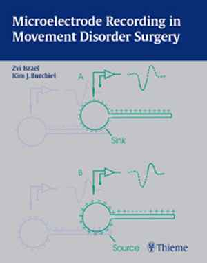 Microelectrode Recording in Movement Disorder Surgery 1st