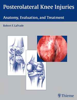 Posterolateral Knee Injuries: Anatomy, Evaluation, and Treatment 1st