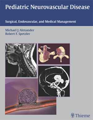 Pediatric Neurovascular Disease: Surgical, Endovascular, and Medical Management 1st