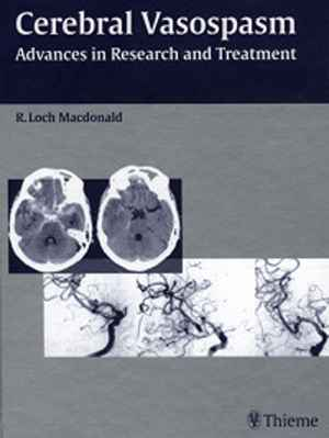 Cerebral Vasospasm: Advances in Research and Treatment 1st