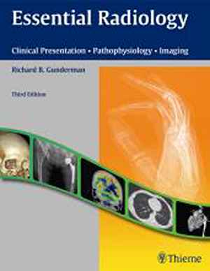 Essential Radiology: Clinical Presentation - Pathophysiology - Imaging 3rd