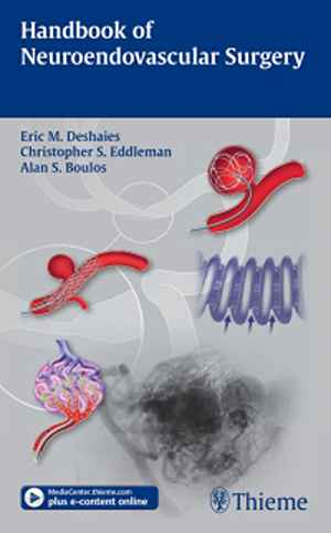 Handbook of Neuroendovascular Surgery 1st