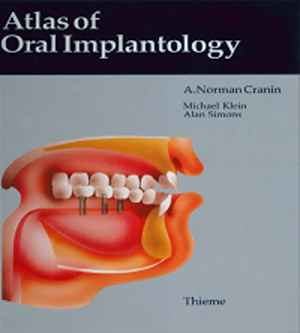 Atlas of Oral Implantology 1st