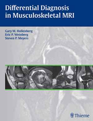Differential Diagnosis in Musculoskeletal MRI 1st