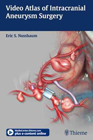 Video Atlas of Intracranial Aneurysm Surgery 1st