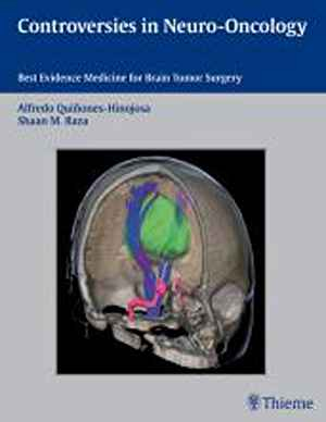 Controversies in Neuro-Oncology: Best Evidence Medicine for Brain Tumor Surgery 1st