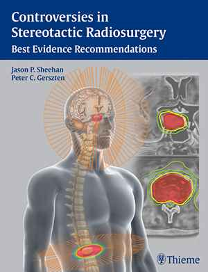 Controversies in Stereotactic Radiosurgery: Best Evidence Recommendations 1st