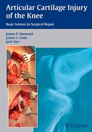 Articular Cartilage Injury of the Knee: Basic Science to Surgical Repair 1st