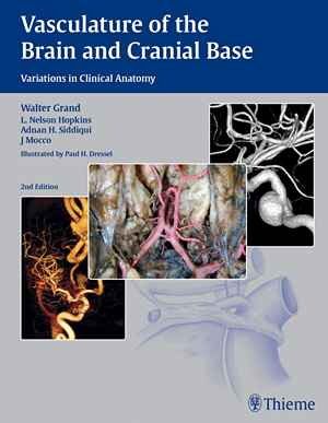 Vasculature of the Brain and Cranial Base: Variations in Clinical Anatomy 2nd