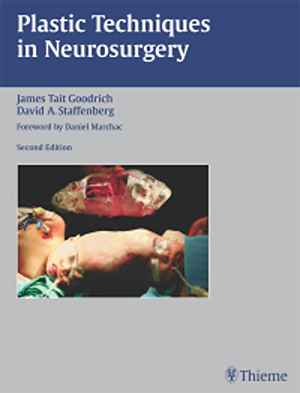 Plastic Techniques in Neurosurgery 2nd