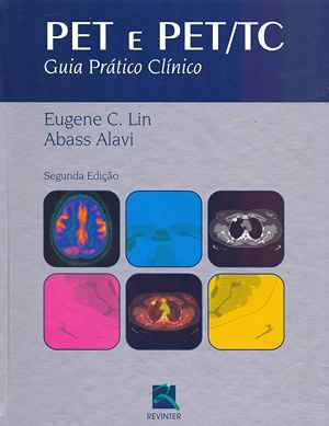 PET e PET/TC: Guia Prático Clínico