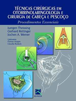 Técnicas Cirúrgicas em Otorrinolaringologia: Procedimentos Essenciais