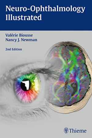 Neuro-Ophthalmology Illustrated 2nd