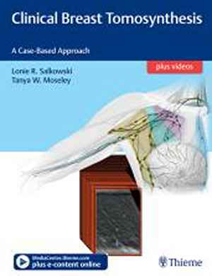 Clinical Breast Tomosynthesis: A Case-Based Approach 1st