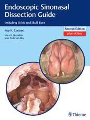 Endoscopic Sinonasal Dissection Guide: Including Orbit and Skull Base 2nd