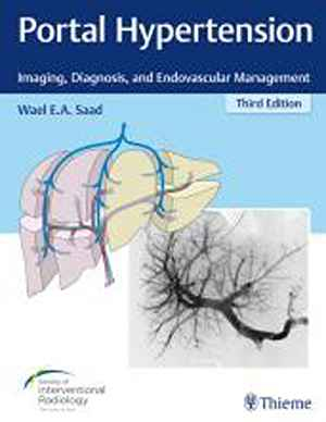 Portal Hypertension: Imaging, Diagnosis, and Endovascular Management 3rd
